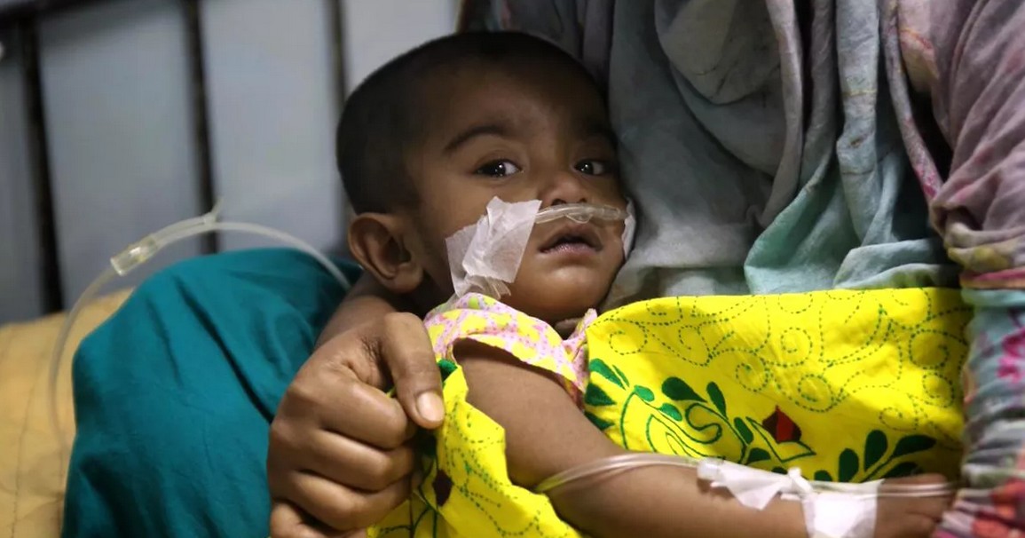 হাম ও উপসর্গ নিয়ে আরও ১১ শিশুর মৃত্যু